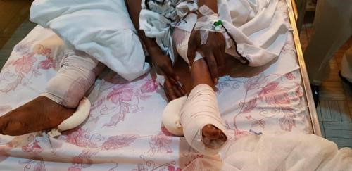 Nord- Kiv u/Rutshuru : Explosion d’une bombe à Bushadara