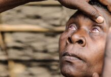 Vue floue : ces 5 maladies des yeux qui menacent silencieusement votre vision