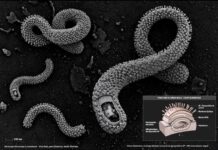 Bas-Uele frappé : Ebola s’étend et le Dr Muyembe met en garde, « le virus nous devance »